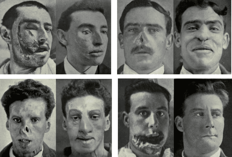 Despite Appearances, Not All People with Scarred Faces are Movie Villains