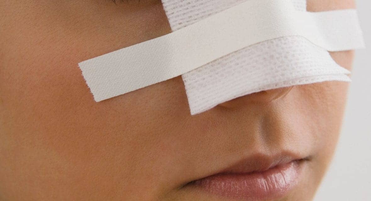 Nose Jobs Are Changing, Thanks to This Millennial Trend