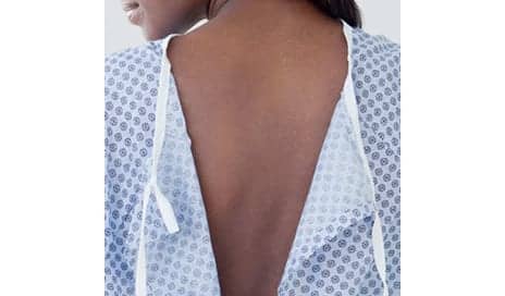 Half of Dermatologists Say They Weren’t Trained to Spot Cancer on Black Skin
