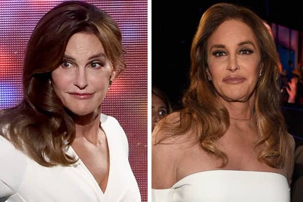Caitlyn Jenner Sparks Extreme Plastic Surgery Speculation with Unrecognisable Appearance
