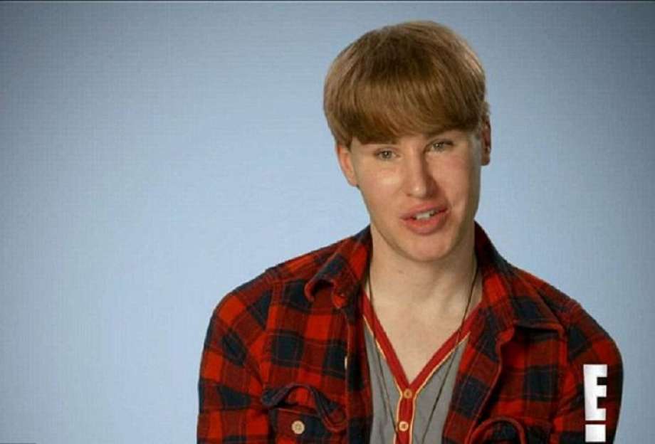 Coroner: Plastic Surgery-Addicted Justin Bieber Fan Died of Drug Overdose