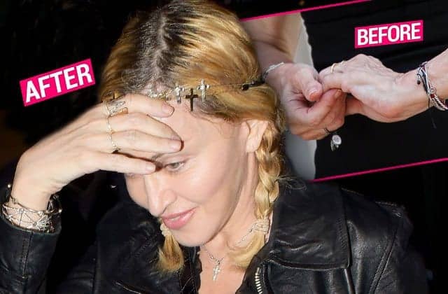 Desperate Measures! Madonna ‘Deveined’ Wrinkly Skin With ‘Drastic’ Surgery, Docs Say