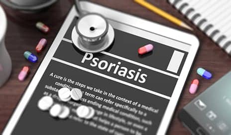 Risankizumab Superior to Other Biologics for Psoriasis in Three Trials