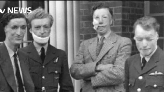 Pioneer ‘Guinea Pigs’ of Plastic Surgery to Reunite