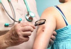 Dermatologist Recommends Zinc-Oxide and Titanium-Oxide-Based Sunscreens to Prevent Skin Cancer