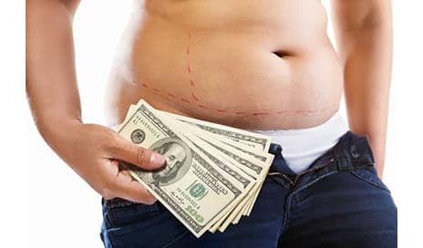Liposuction Results Can Be Permanent, Says Sacramento Plastic Surgeon