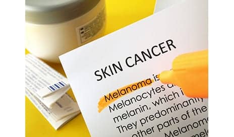 African-American Organ Transplant Recipients At Risk for Skin Cancer