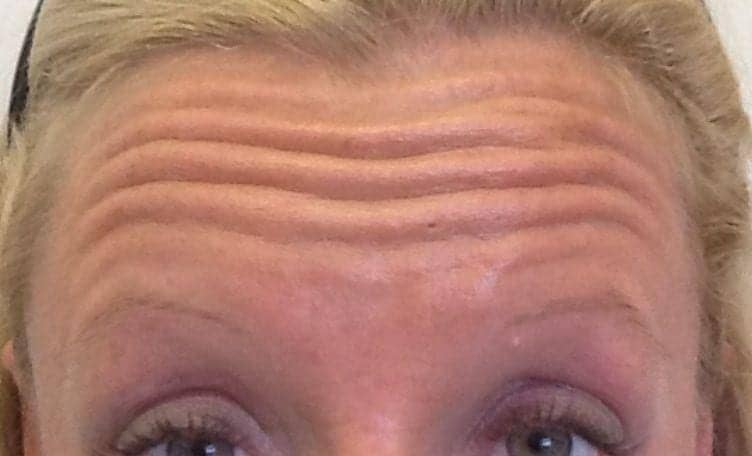 Cosmetic Dermatology Gains in Popularity