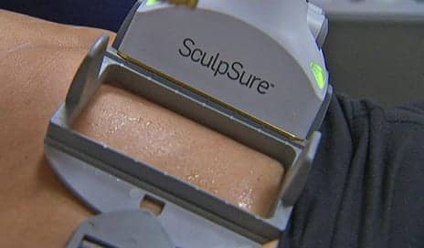 SculpSure: Can This Non-Surgical Procedure Melt Body Fat?