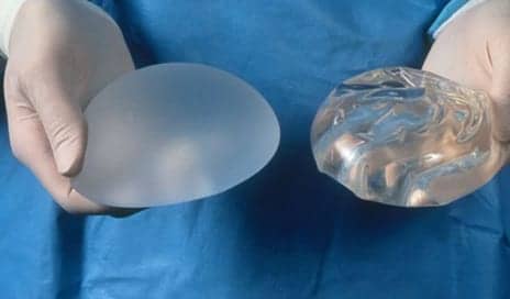 Breast Implant Register Launches 'to Safeguard Patients'