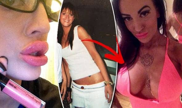 ‘Nothing Is EVER Big Enough’ 32GG Buxom Babe Reveals Shocking Implant Addiction