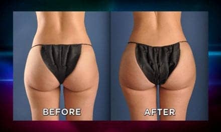 Hollywood's New Male Cosmetic Surgery Trend: Scrotox (Yes ...