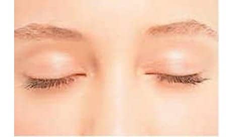 Turning Back the Clock with An Eyelid Lift