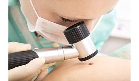 Melanoma Prevention—Avoiding Indoor Tanning and Minimizing Overexposure to the Sun