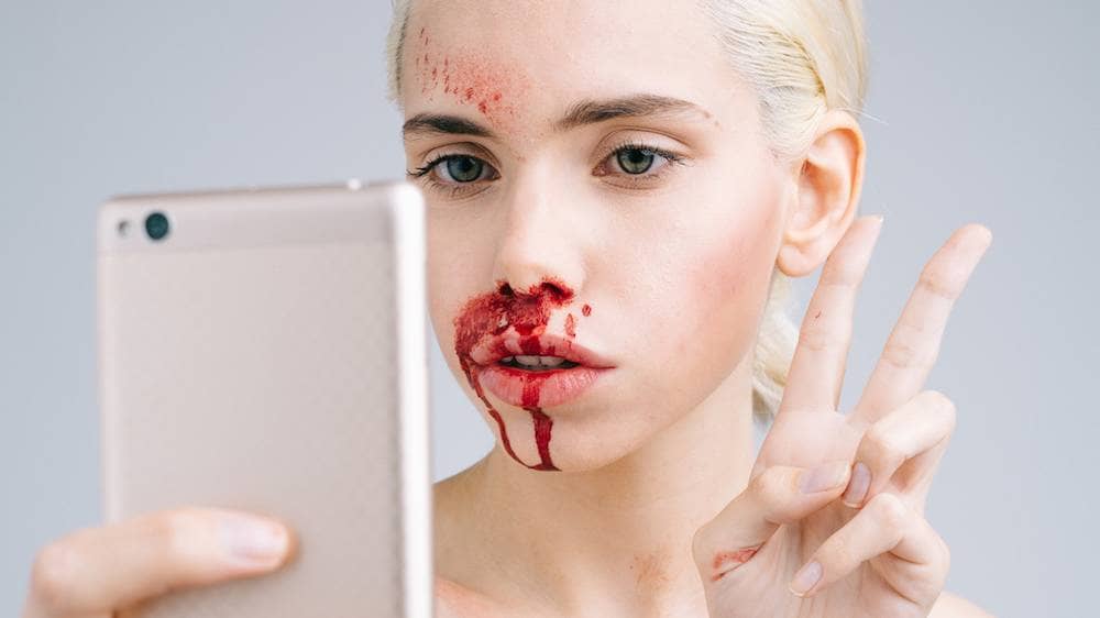 Inside Instagram’s Secretive Plastic Surgery Support Community