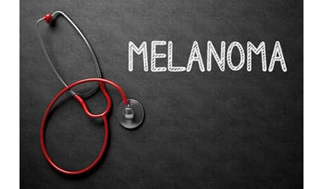 Delays for Melanoma Surgeries Linked to Insurance Type