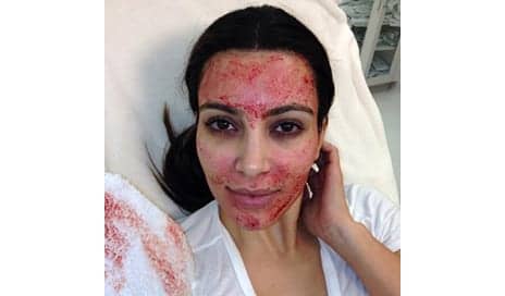 Is This $1,000 Blood Face Cream the Next Vampire Facial?