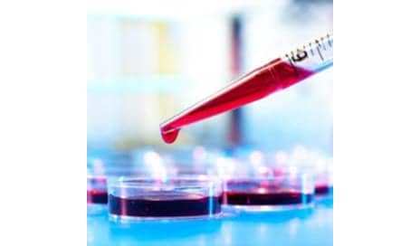 Biomarkers Predict How Well You’ll Age