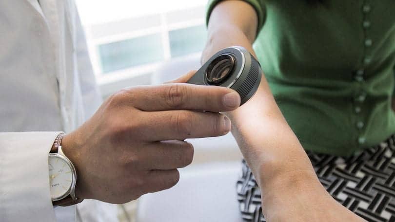 AI Rivals Human Dermatologists at Detecting Skin Cancer