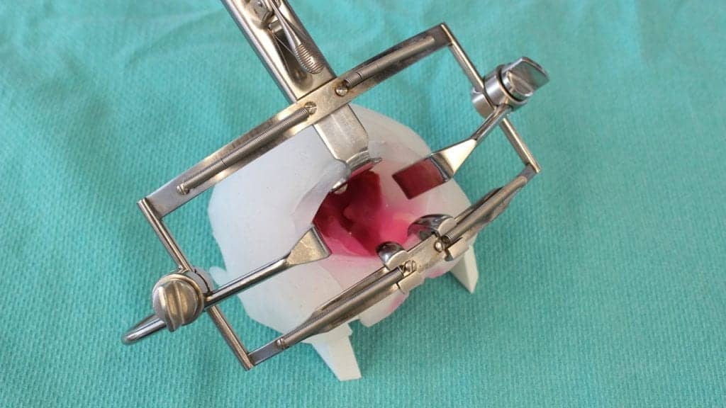 Cleft Lip and Palate Surgery Has Been Taught for Decades Using Styrofoam Cups, But 3-D Technology Is Changing That