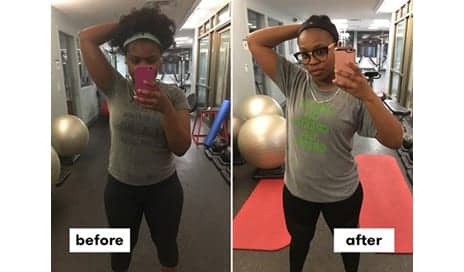 I Tried Botox For Sweating And Haven’t Used Antiperspirant For Months