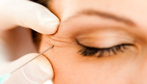 Considering Botox? Here’s How (and When) to Start Doing It Right