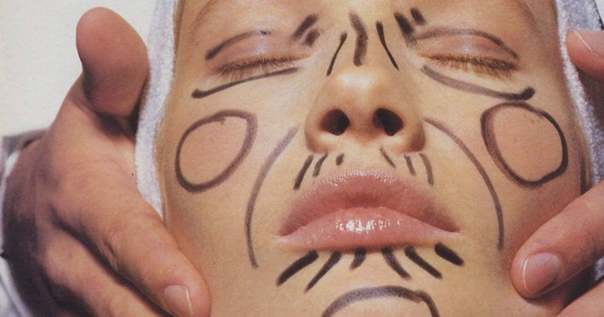 Are Microtreatments the New Facelifts? One Writer’s Yearlong Journey to a Fresher Look