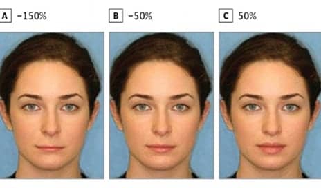 Are Your Lips Attractive? Plastic Surgeons Reveal the Exact Ratio of the Perfect Pout