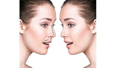 Experts Develop Evidence-Based Clinical Practice Guideline on Rhinoplasty