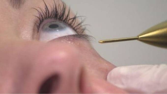 Could Botox Improve Our Wellbeing?