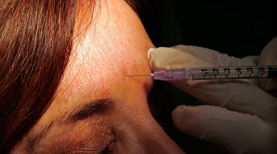 ‘Botox Away’: High-Powered Professionals Turn to Facial Injections to Hide Emotions at Work