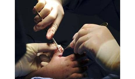 Born with Five Thumbs, Infant Receives Plastic Surgery