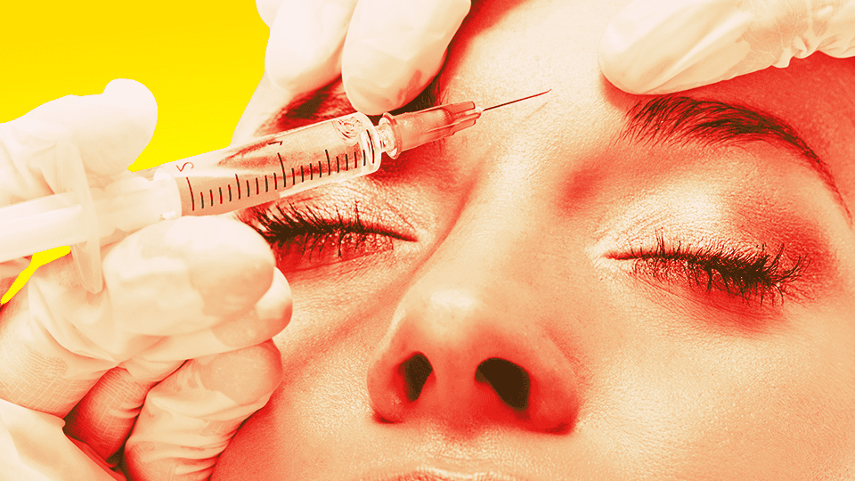 I Did It. I Got Botox Twice—Here’s Why