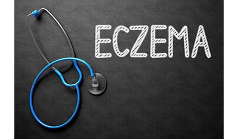 Black Children Less Likely to Receive Treatment for Eczema Despite Increased Severity