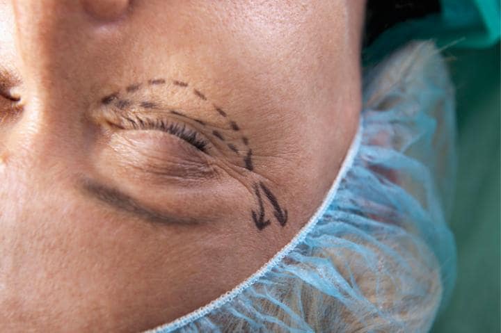 How a Face-Lift Can Aid Success (and Even Help You Escape a Speeding Ticket)