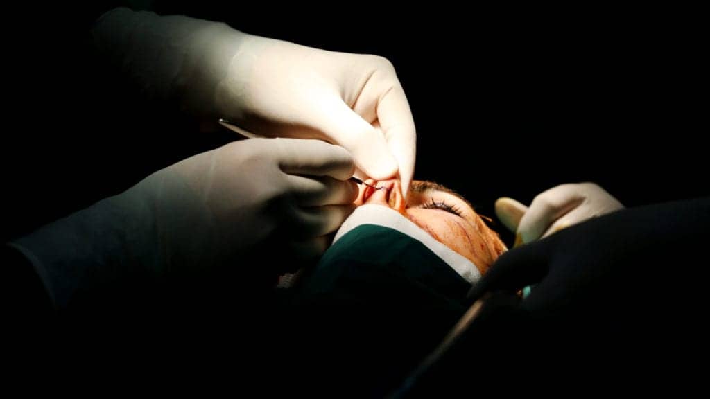 Should Insurance Cover Cosmetic Surgery?