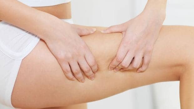 9 Effective Ways to Get Rid of Cellulite