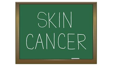 Study Finds Merkel Cell Carcinoma Incidence Has Increased Since 2000