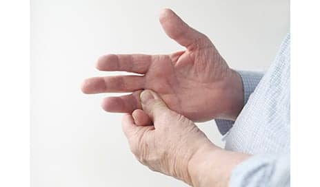 Botulinum Toxin Has Variable Effectiveness in Patients with Scleroderma-Associated Raynaud’s
