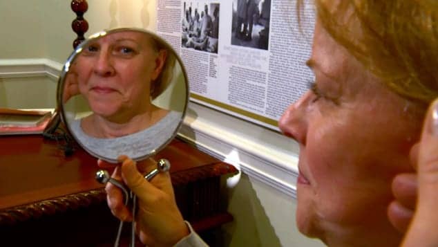 Woman’s Confidence Increases After Weekend Facelift