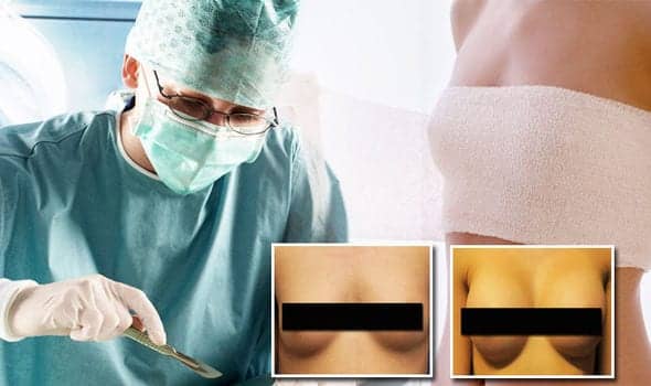 You Won’t Believe the Results of This New Boob Job Procedure