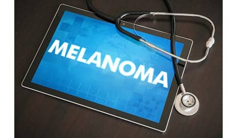 Modern Estrogen ‘Microdoses’ in Contraceptives Did Not Increase Risk of Melanoma