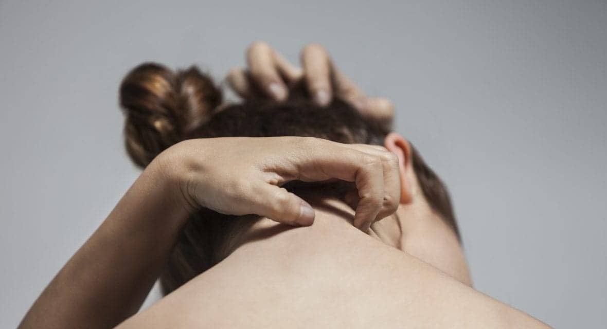 5 Ways To Stop Eczema From Ruining Your Summer