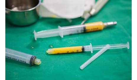 ASERF Outlines Recommendations to Increase Safety of Gluteal Fat Grafting Procedures
