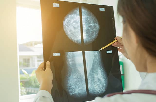 Doctor Performed Mastectomy for Nonexistent Cancer, Lawsuit Says