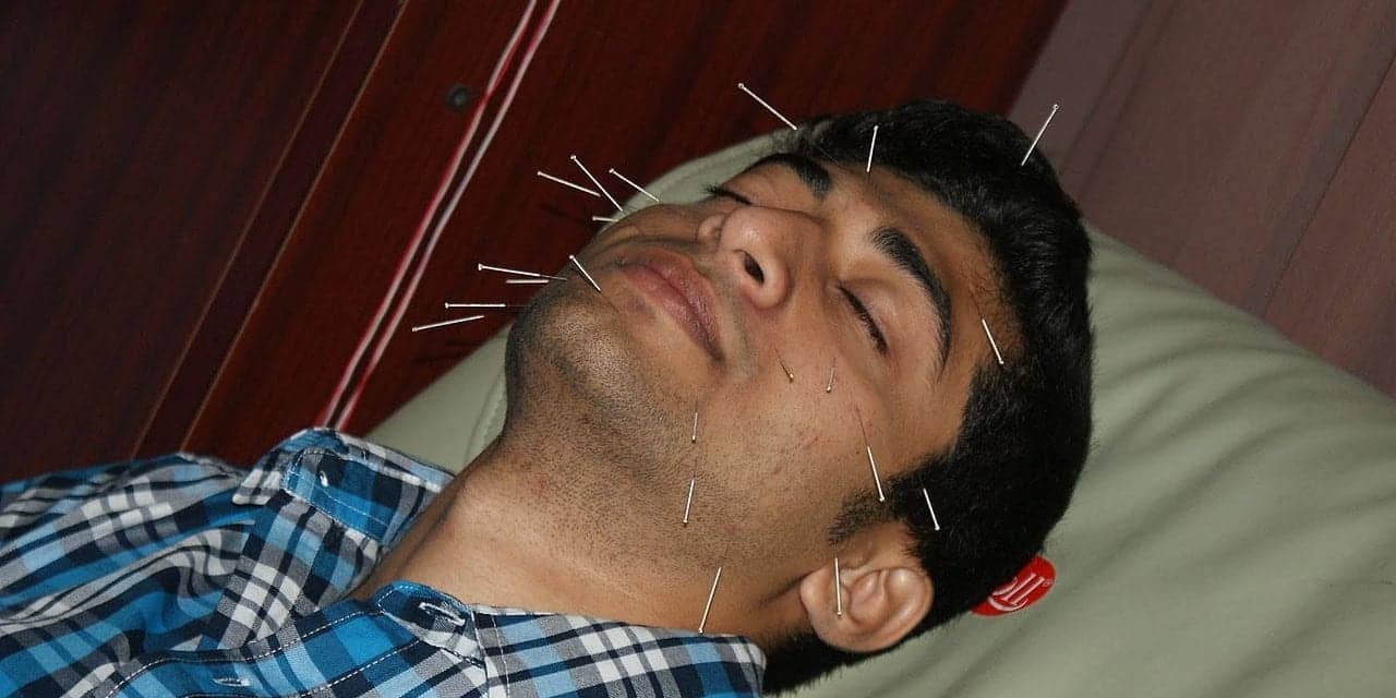 Constitutional Facial Acupuncture Is the Safer, More Natural Anti-Aging Regimen—Here’s Why