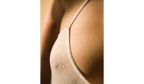 More Women Are Undergoing Nipple Reduction Surgeries — Here's Why