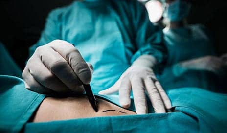 Cosmetic Surgery: The Real Dangers of Fat Injections