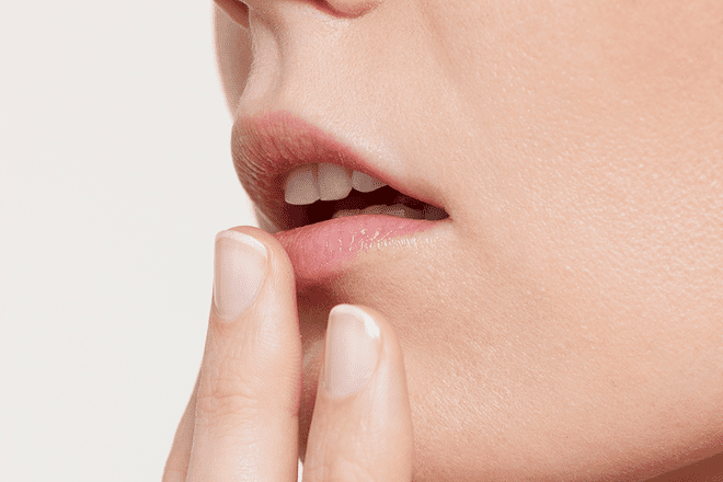 This Is What Happens When Lip Fillers Go Wrong