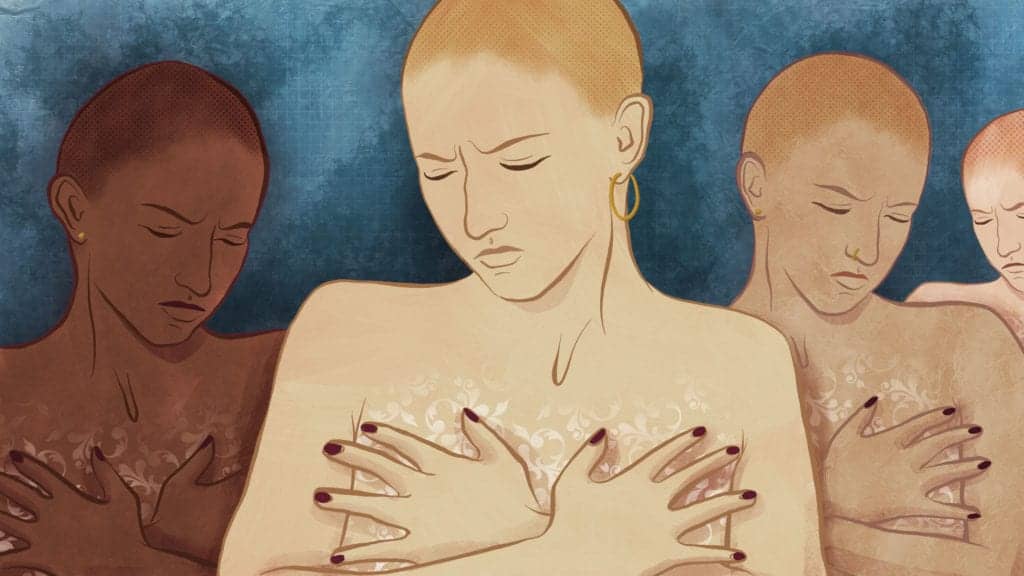 Why a Growing Number of Women with Breast Cancer Are Choosing Double Mastectomy